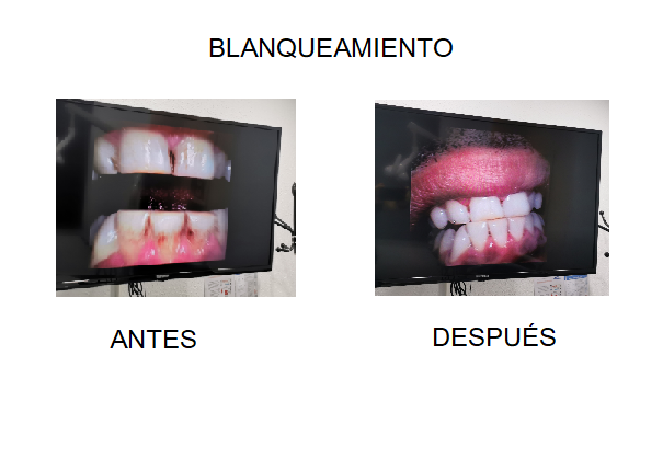 dentista cornella de llobregat clinica